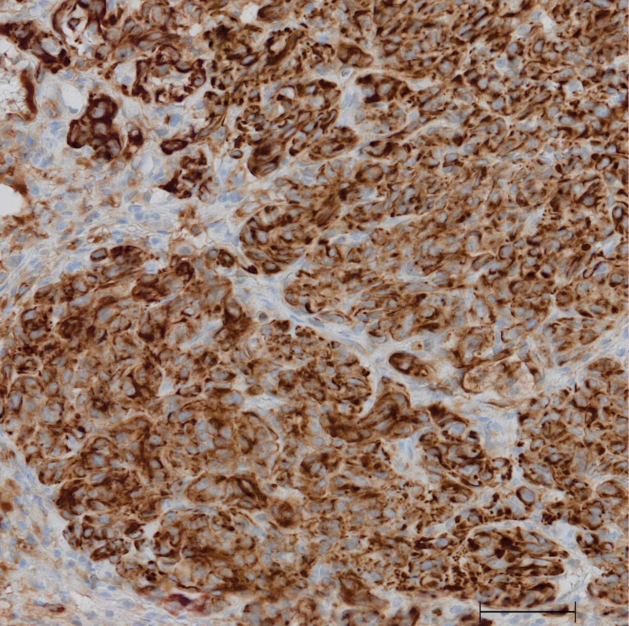 how to optimize IHC staining 
